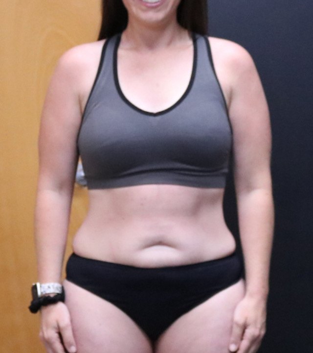 Anonymous Client after
