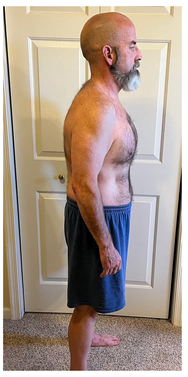Greg after