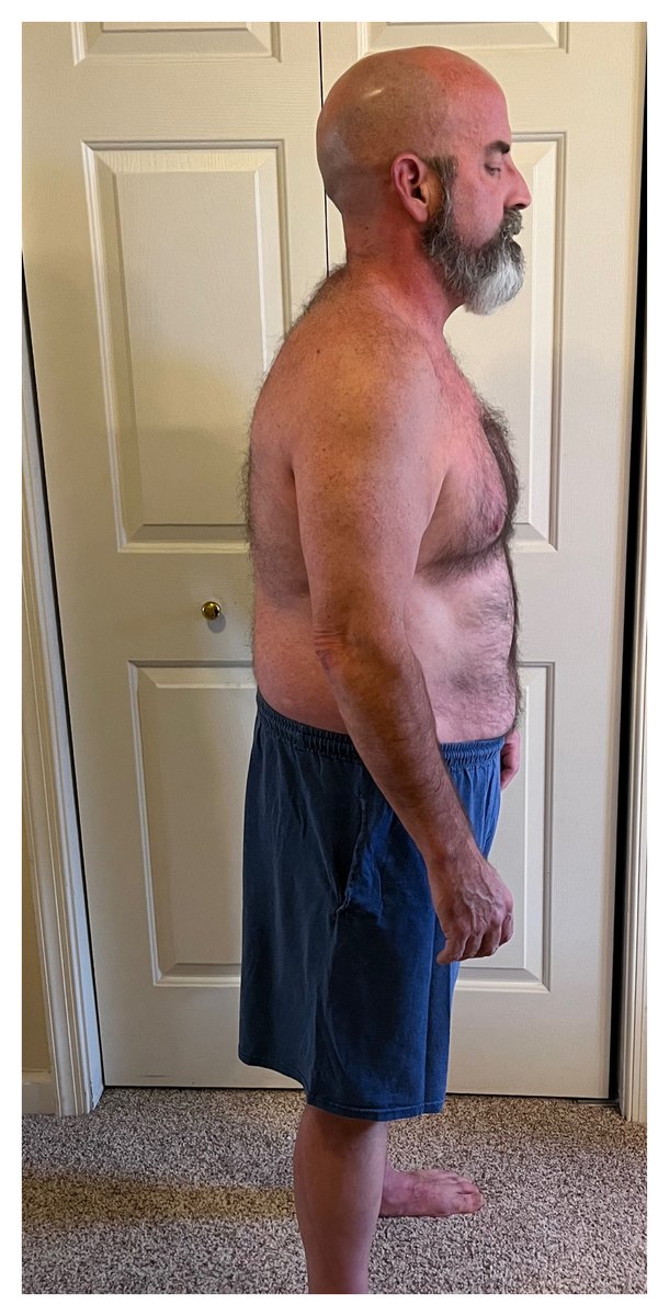 Greg before